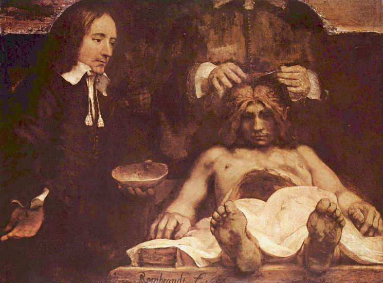 Рембрандт Харменс ван Рейн: Лекция по анатомии доктора Деймана. Фрагмент